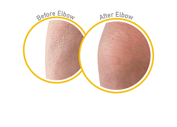 O'Keeffe's Skin Repair for Severe Dry Skin, 12OZ Pump