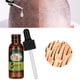 thumbnail image 1 of Suero Para El Cabello, Repara Los Folículos Pilosos, Nutre El Cuero Cabelludo, Fortalece Las Raíces Del Cabello, Aceite Para El Crecimiento Del Cabello, 30 Ml Para La Calvicie,, 1 of 7