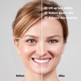 thumbnail image 4 of Electric V Face Shaping Machine Double Chin Reducer Machine V-Face Massager Beauty Device,White, 4 of 10