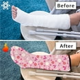 thumbnail image 7 of COEQINE Breast Cancer Pink Ribbon Leg Cast Cover Large Fashionable Leg Cast Cover Sock Broken Leg Shower Cast Cover Adjustable Elastic Cast Socks Cover Cast for Women Men Seniors, 7 of 7