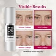 thumbnail image 3 of Sérum para ojos 5th & Glow CyaBags, reducción instantánea de ojos hinchados, 3 of 6