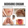 thumbnail image 1 of Crema para escaras, crema hidratante para úlceras por presión, crema para úlceras de decúbito para el cuidado del cuerpo, 1 of 9
