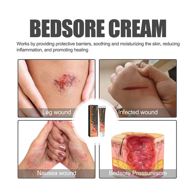 Crema para escaras, crema hidratante para úlceras por presión, crema para úlceras de decúbito para el cuidado del cuerpo