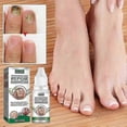 thumbnail image 3 of 1-3X Essential Oil Nail Fungus Repair Liquid Nail Thickening Discoloration Off Soft Nail Thickening Type Onychomyc 20ml, 3 of 5