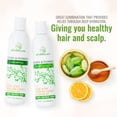 thumbnail image 4 of Set de champú y acondicionador Wild Naturals Eccema Psoriasis, 4 of 9