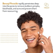 AcneFree Terminator 10 Acne Spot Treatment Cream with 10% Benzoyl Peroxide, 1 fl oz
