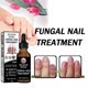 thumbnail image 1 of Nail Treatment Thickening And Shining Nail Removal Gray Nail Repair Nourishing Nail Treatmen, 1 of 5