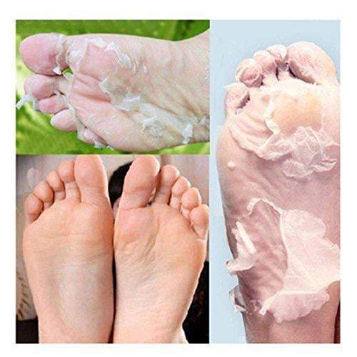 Aliver Foot Peel Mask (3 Pack), Exfoliating Foot Peel Mask for Cracked