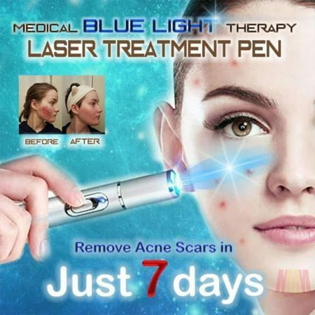 - Handheld Picosecond Laser Pen Tattoo Scar Freckle Removal Machine Skin Beauty Device, Tattoo Removal Laser Pen, Spot Removal Laser Pen