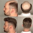 thumbnail image 6 of Fine Mono NPU Men's European Human HairHuman Hair Men Toupee Wigs  Natural Hairline Hairpieces PU Replacement System Men Wig, 6 of 6