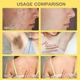 thumbnail image 4 of Crema de veneno de abeja Botou Professional Repair, 2 unidades, 4 of 7