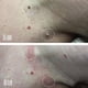 thumbnail image 2 of IBeaLee Cross border Wart Removal Liquid, Youfu Flat Liquid, Huangzi Point Mole Liquid, Chicken Eye Filament Flat Youde Removal Liquid, 2 of 5