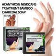 thumbnail image 2 of 1pc Jaysuing Underarm Whitening Soap Deep Cleansing And Repairing Dark Skin Black Acanthopsia Moisturizing Whitening Skin Soap, 2 of 4