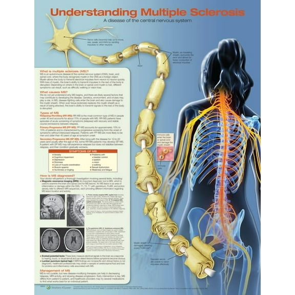 Understanding Multiple Sclerosis Anatomical Chart (Other)