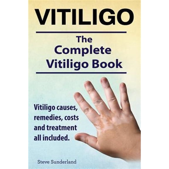 Pre-Owned Vitiligo. Vitiligo causes, remedies, costs and treatment all included. The complete Vitiligo Book. (Paperback)