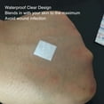 thumbnail image 3 of Clear Spot Bandage, Waterproof Round Shape Mini Easy Peel Off Wound Care Spots Bandages 100 Count 22mm For Children For Minor Cuts, 3 of 8