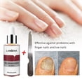 thumbnail image 2 of Nail Repair Essence With a Small File Protect Nail Repair Nail Toenail for Curing Nail from Infection Damaged, 2 of 8