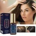 thumbnail image 1 of Fiudx Solución Capilar, Suero para Crecimiento Capilar En Fórmula Herbal, Fortalecedor Capilar En Extracto de Jengibre, Nutritivo Capilar En Polygonum Multiflorum, Cabello Grueso, Apto Hombres y Muje, 1 of 7