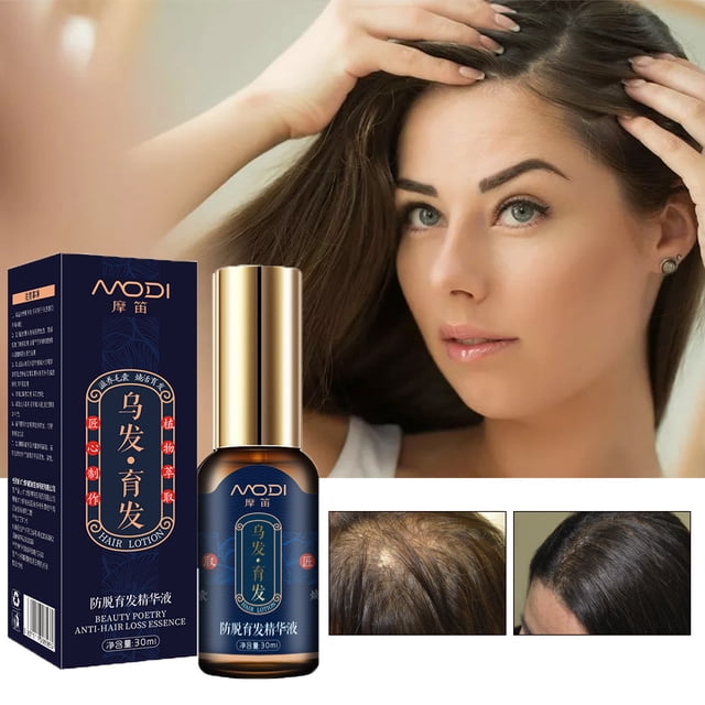Fiudx Solución Capilar, Suero para Crecimiento Capilar En Fórmula Herbal, Fortalecedor Capilar En Extracto de Jengibre, Nutritivo Capilar En Polygonum Multiflorum, Cabello Grueso, Apto Hombres y Muje