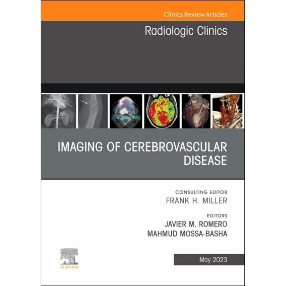 Clinics: Radiology Imaging of Cerebrovascular Disease, an Issue of Radiologic Clinics of North America: Volume 61-3, Book 61, (Hardcover)