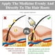 thumbnail image 2 of Tratamiento Capilar con Aceite de Romero para Cabello Saludable y Brillante, 2 of 7