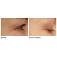 thumbnail image 3 of ($159 Value) Dr. Dennis Gross SpectraLite EyeCare Pro LED Device, 3 of 7