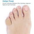 thumbnail image 6 of Nogis Toe Protector Tubular Finger Bandage Gel Toe Caps Toe Sleeve Corn Pads Foam Tube Support 5pcs, 6 of 9