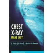 Chest X-Ray Made Easy, Used [Paperback]