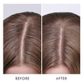 thumbnail image 5 of Moroccanoil Dry Scalp Treatment 1.5 Fl Oz, 5 of 5