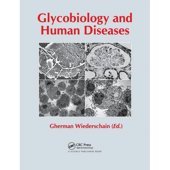 Glycobiology and Human Diseases, (Paperback)