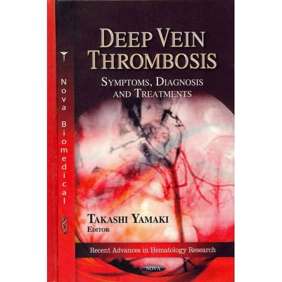 Deep Vein Thrombosis : Symptoms, Diagnosis and Treatments