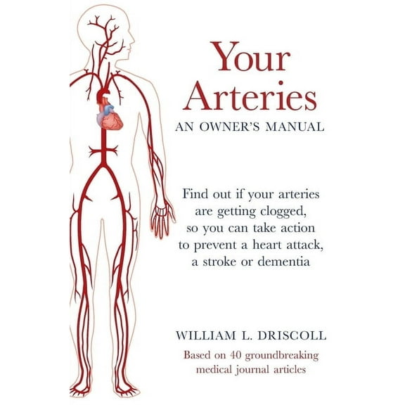 Your Arteries-An Owner's Manual: Find out if your arteries are getting clogged, so you can take action to prevent a hear, (Paperback)