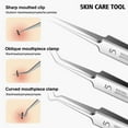 thumbnail image 3 of Acne Needle Kit Blackhead Remover Pimple Blemish Comedone Extractor Tweezer HOT H6O0, 3 of 5
