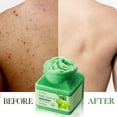 thumbnail image 1 of onlyliua Liquidación Exfoliante Clarificante Exfoliante Corporal Limpiador Exfoliant Limpiador Exfoliante para Cuerpo Muerto 500G, 1 of 7