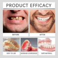 thumbnail image 3 of Suction-fit Complete Denture, Silicone Full Denture Set, Multifunctional Silicone Denture Set, For Men And Women (1pcs) 1pcs, 3 of 3