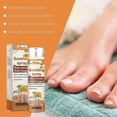 thumbnail image 5 of Bee Venom Nail Soothing Spray, Bee Venom Nail Fungus Soothing Spray, Toe Nail Treatments for Damaged Nails, Nail care, Safely and Gently, 20ml, 5 of 5