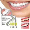 thumbnail image 2 of Ampoule Toothpaste, Ampoule Tooth Serum, Ampoule Essence Toothpaste New, 2 of 5