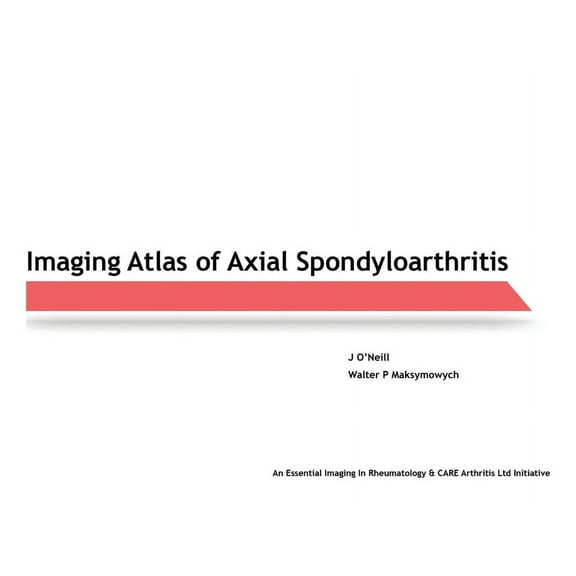 Imaging Atlas of Axial Spondyloarthritis, (Paperback)