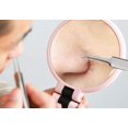 thumbnail image 3 of 6 uds removedor de espinillas, Extractor de comedones, Kit de eliminación de acné para imperfecciones, estallidos de espinillas, eliminación de zit para herramientas faciales de na, 3 of 4