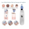 thumbnail image 4 of Extractor Por Succion Puntos Negros, Espinillas Dermasuction Portatíl|, 4 of 5