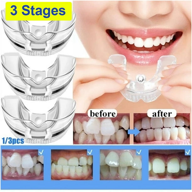KingFurt Teeth Straighten Tool 3 Pcs/Stage Dental Orthodontic Braces Fake Braces Kit for Teeth
