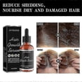 thumbnail image 3 of 2pcs Fast Growing Anti Hair Loss Essential Oil Rosemary Hair Grow, 3 of 5