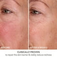 thumbnail image 6 of Dr. Dennis Gross Derminfusions Fill + Repair Serum - 1oz, 6 of 8