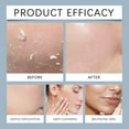 thumbnail image 2 of Peel Pads - Glycolic_Acid Resurfacing Pads for Face & Body Fine Line_s and Wrinkle_s(1PCS,50Pads), 2 of 8