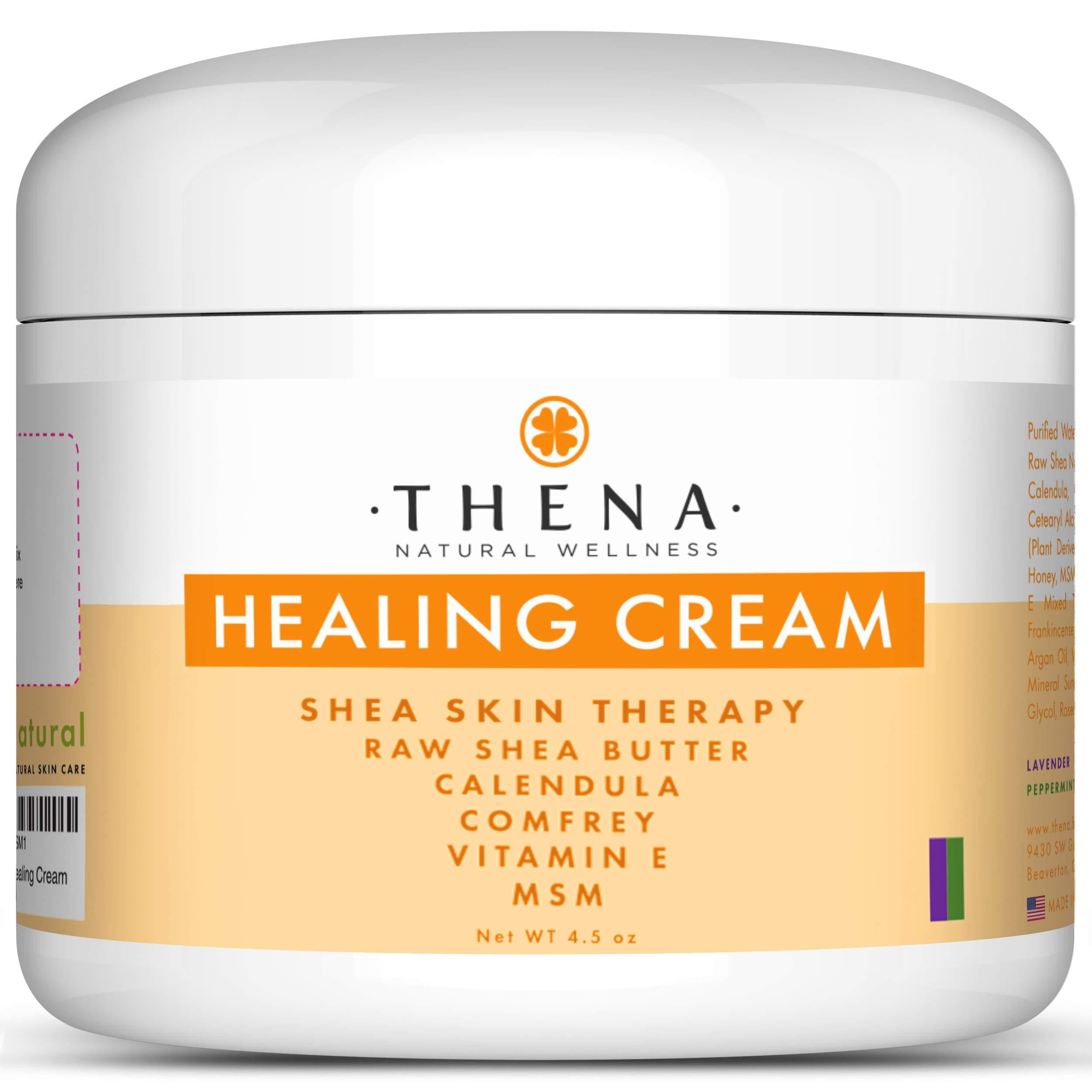 Eczema Psoriasis Cream Lotion, Best For Dry Itchy Skin Rosacea Rashes