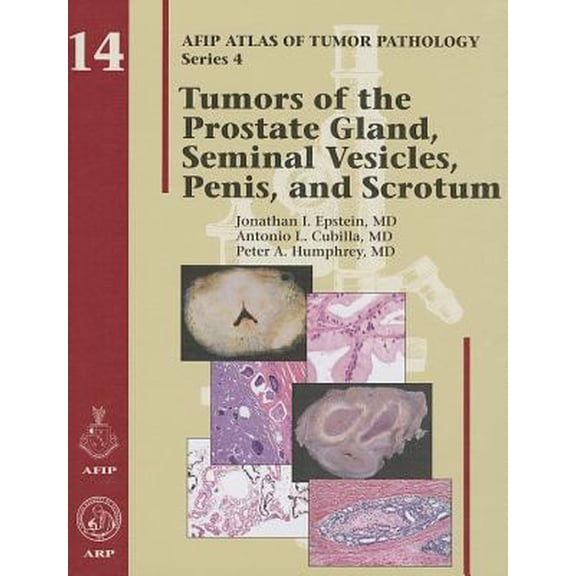 Pre-Owned Tumors of the Prostate Gland, Seminal Vesicles, Penis, and Scrotum (Hardcover) 1933477148 9781933477145