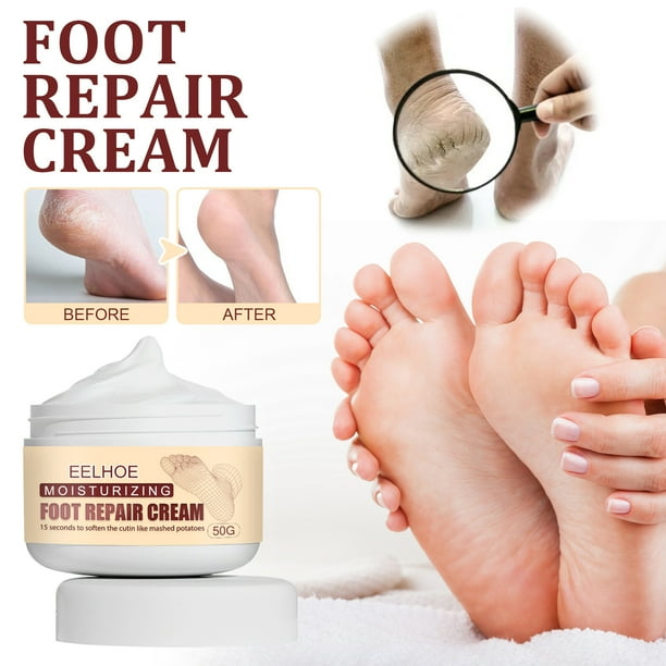 JUBFBFBF Urea Foot Urea Foot Lotion Hydrates Callus Remover