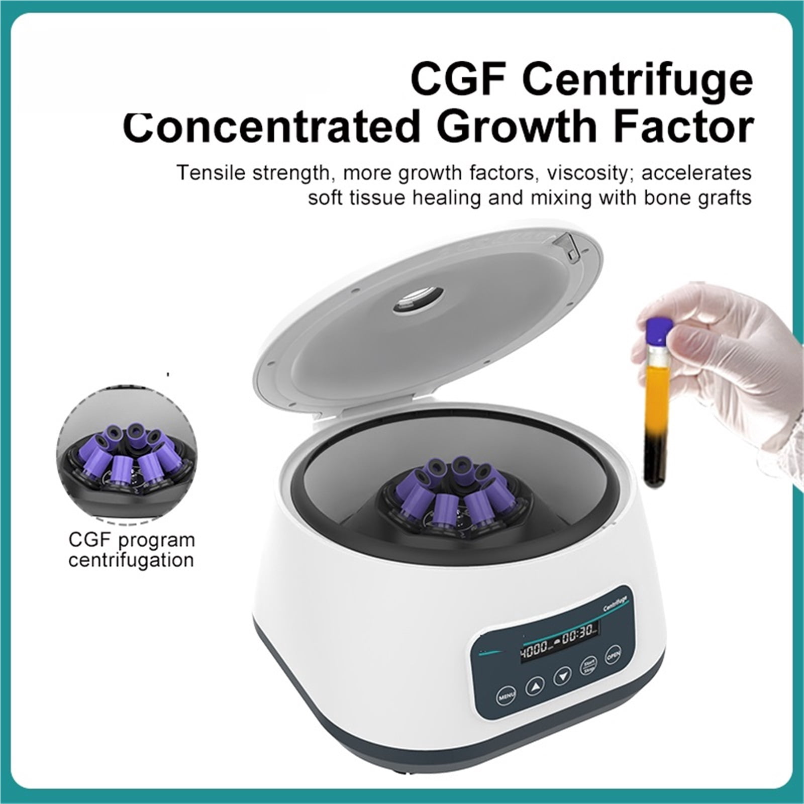 Centrifuge Laboratory Cgf Centrifuge Machine 5/10ml Collection Tube 15ml Centrifuge Tube 1717xg 4000rpm ,Efficient Separation