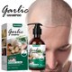 thumbnail image 3 of Ganfancp Champú Al Ajo Sin Perfume para Cabello Normal a Seco Lo Último En Cabello con Extracto de Aceite de Ajo Sin Perfume 100Ml Ofertas Flash Liquidación 1Xchampú Al Ajo, 3 of 7