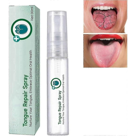 Instant breath freshener spray for tongue repair and odour